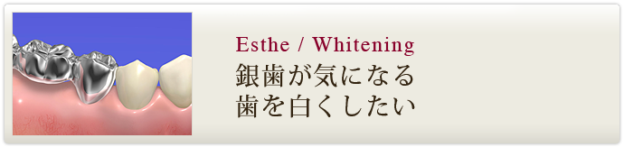 銀歯が気になる　歯を白くしたい
