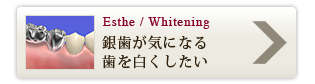 銀歯が気になる歯を白くしたい