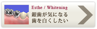 銀歯が気になる歯を白くしたい